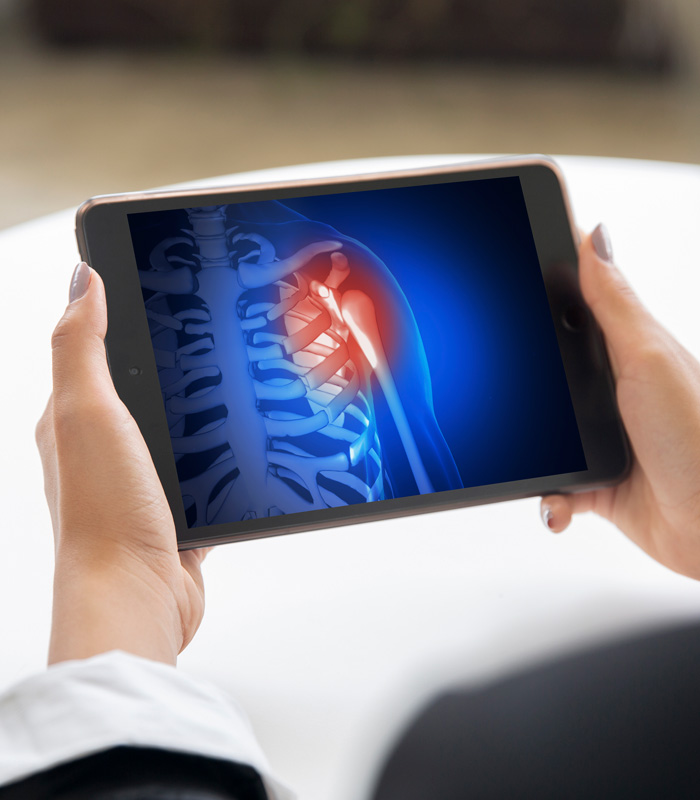 Digitale Röntgen Diagnostik